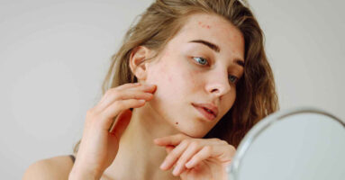 cura pelle ed intestino