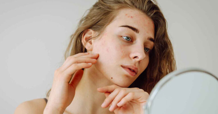 cura pelle ed intestino